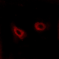 3 - Anti-CMKLR1 Antibody AP59519