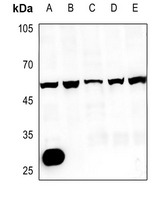 1 - Anti-CMKLR1 Antibody AP59519