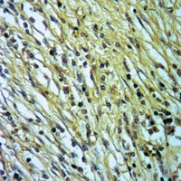 19 - Anti-Carboxypeptidase N 1 Antibody AP59522