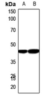 1 - Anti-Carboxypeptidase N 1 Antibody AP59522