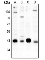 1 - Anti-CREB (Phospho-S133) Antibody AP59524