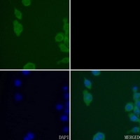 3 - Anti-CK1 delta Antibody AP59525