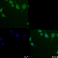 3 - Anti-CK1 gamma 3 Antibody AP59526
