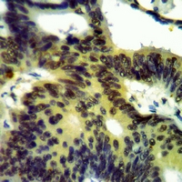 19 - Anti-CK1 gamma 3 Antibody AP59526