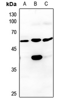 1 - Anti-CK1 gamma 3 Antibody AP59526