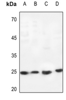 1 - Anti-Cardiotrophin-1 Antibody AP59528