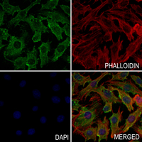 3 - Anti-Cathepsin V Antibody AP59529