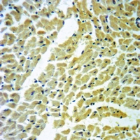 19 - Anti-Cathepsin V Antibody AP59529