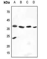 1 - Anti-Cathepsin V Antibody AP59529