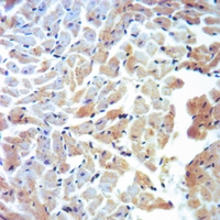 19 - Anti-Cytochrome P450 11A1 Antibody AP59531
