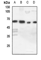 1 - Anti-Cytochrome P450 11A1 Antibody AP59531