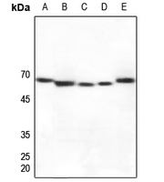 1 - Anti-Cytochrome P450 27A1 Antibody AP59532