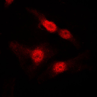 3 - Anti-DGK alpha Antibody AP59533