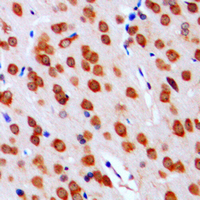 19 - Anti-DGK alpha Antibody AP59533