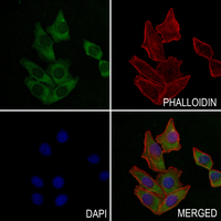3 - Anti-DGK beta Antibody AP59534