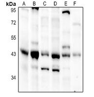 1 - Anti-DHPS Antibody AP59535