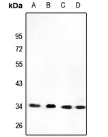 1 - Anti-CYB5R3 Antibody AP59536