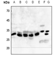 1 - Anti-NQO1 Antibody AP59537