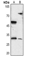 1 - Anti-DIO3 Antibody AP59538
