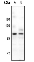 1 - Anti-PSD93 Antibody AP59539