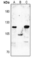 1 - Anti-Dynamin 1 (Phospho-S774) Antibody AP59540