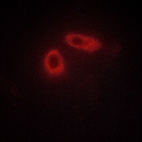 3 - Anti-Ephrin A1 Antibody AP59541