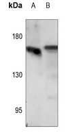 1 - Anti-EGFR (Phospho-S1071) Antibody AP59542