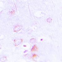 19 - Anti-EPB41L2 Antibody AP59546
