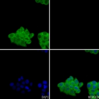3 - Anti-Factor II APII Antibody AP59548