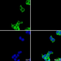3 - Anti-FASN Antibody AP59549