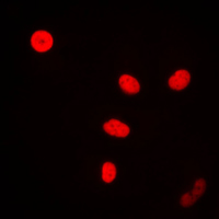 3 - Anti-FEN1 Antibody AP59550