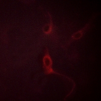 3 - Anti-FGFR1 (Phospho-Y654) Antibody AP59552