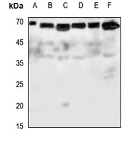 1 - Anti-Glypican 5 Antibody AP59554