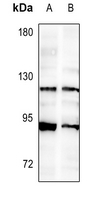 1 - Anti-FGFR2 Antibody AP59555