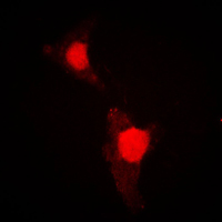 3 - Anti-FOXO1 (Phospho-S319) Antibody AP59556