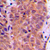 19 - Anti-FOXO1 (Phospho-S319) Antibody AP59556