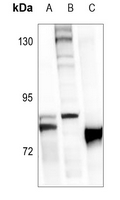 1 - Anti-FOXO1 (Phospho-S319) Antibody AP59556