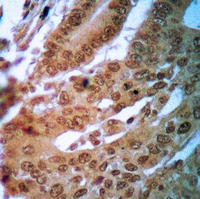 19 - Anti-FR alpha Antibody AP59557