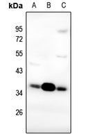 1 - Anti-FR alpha Antibody AP59557