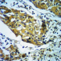 19 - Anti-mTOR Antibody AP59558