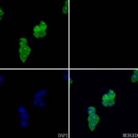 3 - Anti-FYB Antibody AP59559