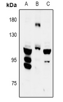 1 - Anti-FYB Antibody AP59559