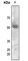 1 - Anti-FYN (Phospho-Y530) Antibody AP59560