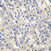 19 - Anti-Galactose Kinase Antibody AP59563