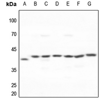 1 - Anti-Galactose Kinase Antibody AP59563
