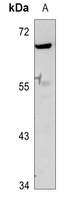 1 - Anti-GDF9 Antibody AP59564