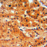 19 - Anti-GCLC Antibody AP59565