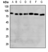 1 - Anti-GCLC Antibody AP59565