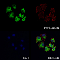 3 - Anti-GRK5 Antibody AP59568