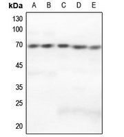 1 - Anti-GRK5 Antibody AP59568